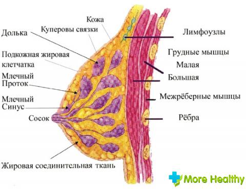 папиллома молочной железы