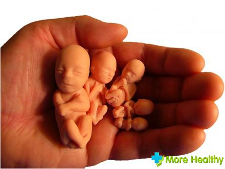 первый аборт