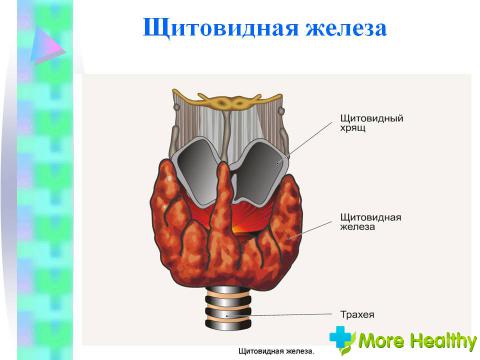 Щитовидная железа 1 степени