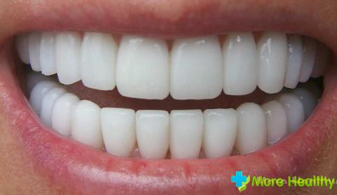 Фото 2 - Здоровые зубы