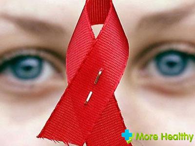 симптомы ВИЧ инфекции